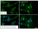All stainings for our hiMicroglia