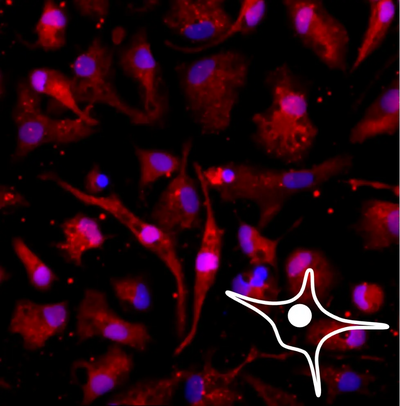 Microscopic fluorescence image of microglia cells with red cytoplasmic IBA1 staining, purple nuclei, and a white star-shaped cell outline in the lower right corner.