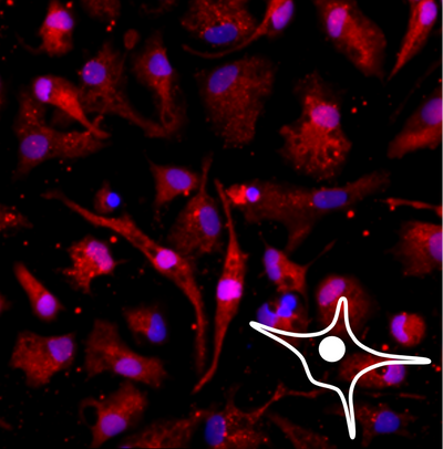 Microscopic fluorescence image of microglia cells with red cytoplasmic IBA1 staining, purple nuclei, and a white star-shaped cell outline in the lower right corner.