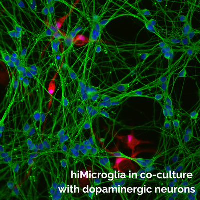 Microscopic fluorescence image of hiMicroglia in co-culture with dopaminergic neurons, showing bright green axons, blue nuclei, and red cell bodies of hiMicroglia on a black background, with white text overlay at the bottom.