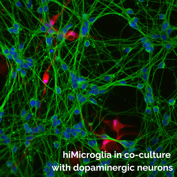 Microscopic fluorescence image of hiMicroglia in co-culture with dopaminergic neurons, showing bright green axons, blue nuclei, and red cell bodies of hiMicroglia on a black background, with white text overlay at the bottom.